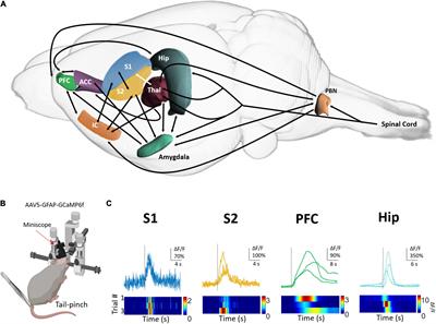 From nociception to pain perception, possible implications of astrocytes